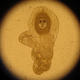 Image for article titled Sounds Gross, But Intestinal Worms Can Actually Be Good For You